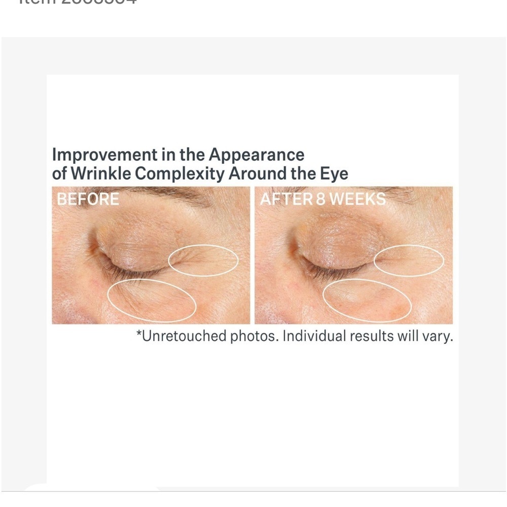Advanced Retinol Multi-Correct
Eye Cream - Picture 6 of 7
